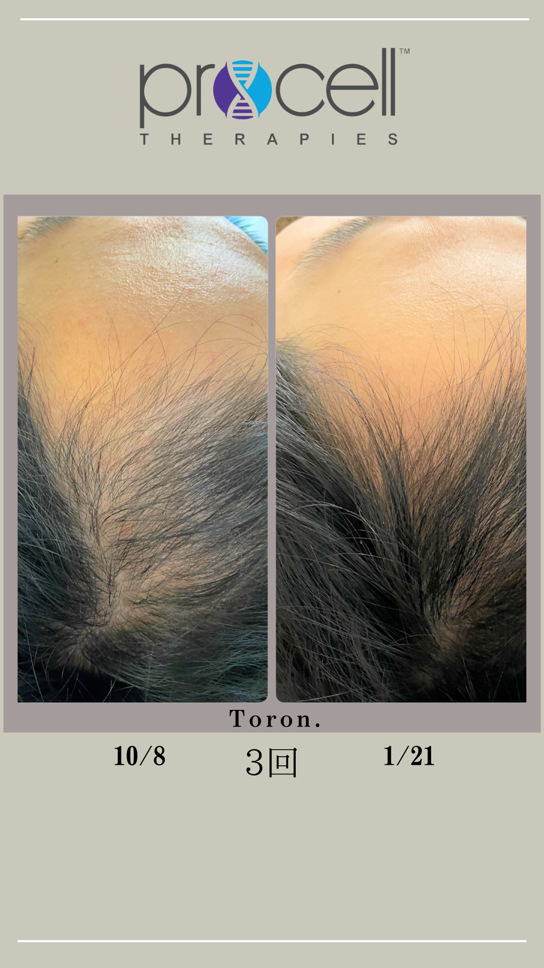 procell theraples プロセルセラピーズ | Toron.